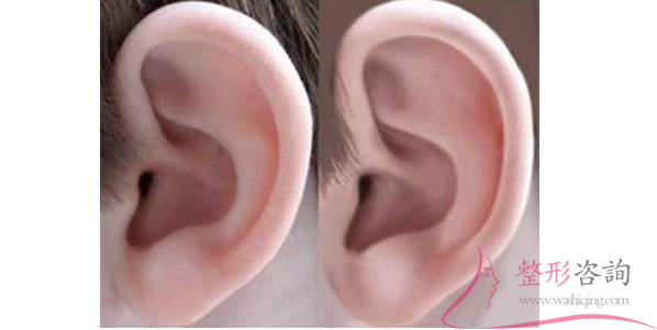 1752175130 1752175130