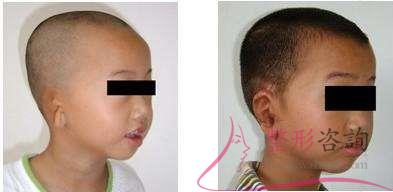 1933007523 1933007523