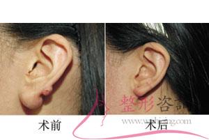 1956361856 1956361856