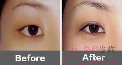 0058283002 0058283002