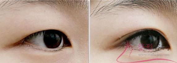 1041213883 1041213883