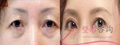 1044258062 1044258062