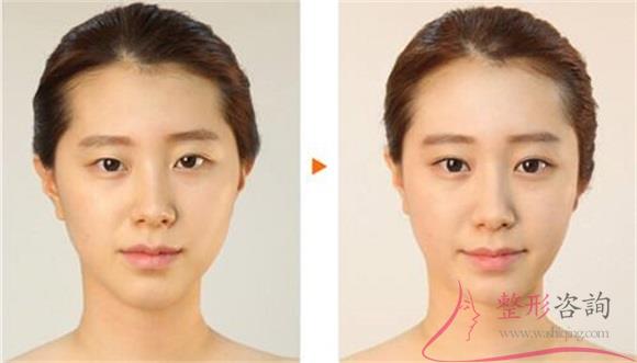 1653071190 1653071190