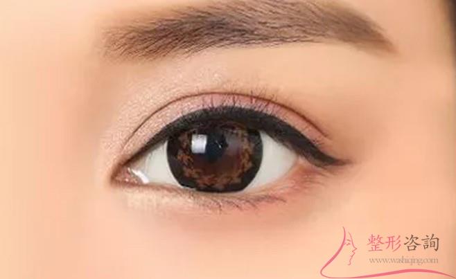 1737241134 1737241134