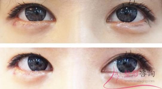 2026474172 2026474172