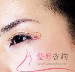 1740113468 1740113468