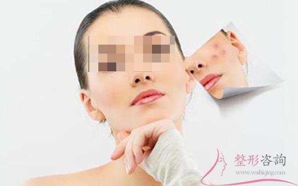 1953343838 1953343838