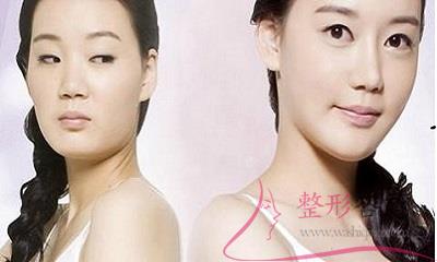 1956432778 1956432778