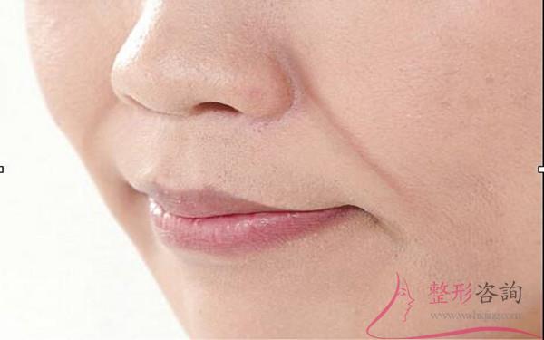 1006019914 1006019914