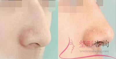 1012467245 1012467245