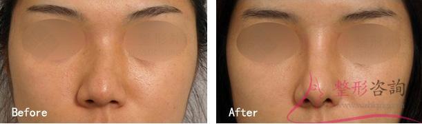 1041492219 1041492219