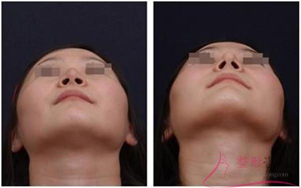 1155535762 1155535762