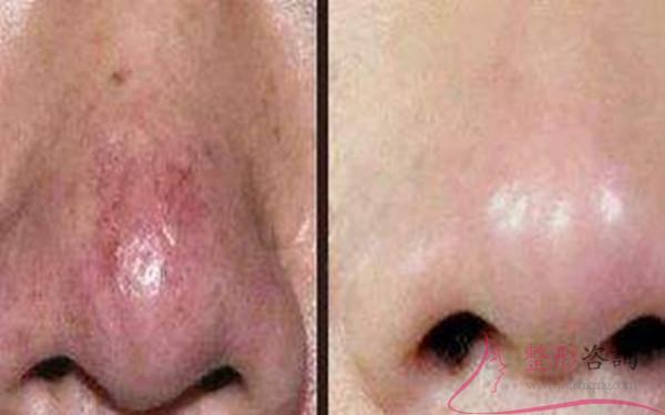 1403108321 1403108321