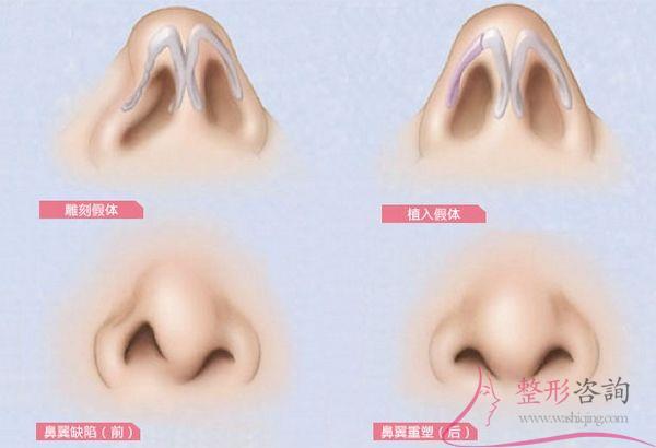 1446165487 1446165487