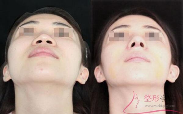 1601148266 1601148266