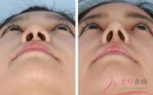 1802392636 1802392636