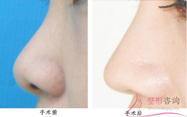 1827427467 1827427467