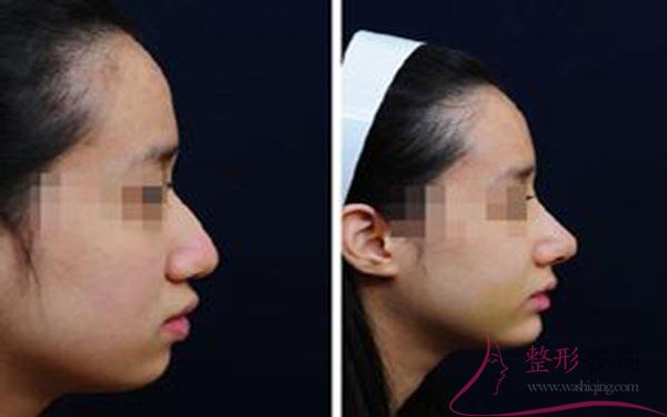 2141197789 2141197789