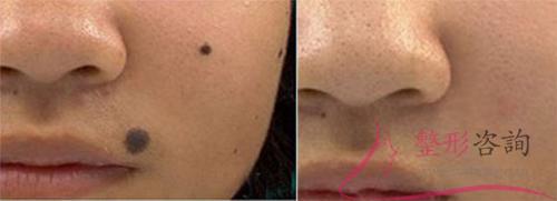 0841126587 0841126587