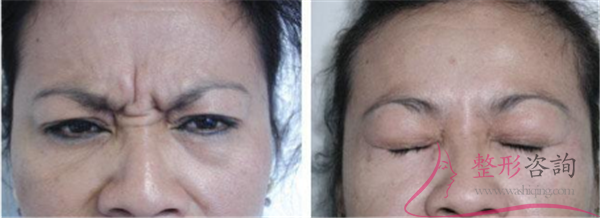 0847482850 0847482850