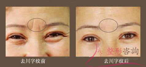 1109559154 1109559154