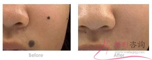 1338436538 1338436538