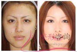 1533031340 1533031340