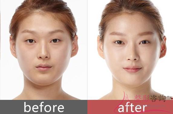 1732571790 1732571790