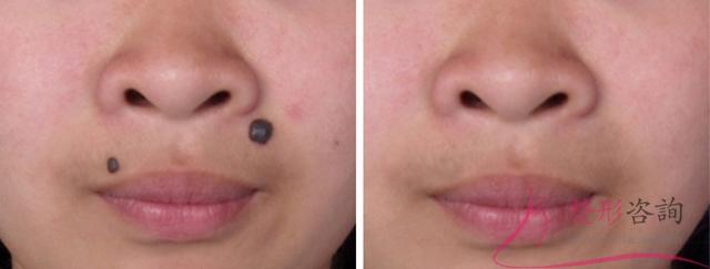 1939345723 1939345723