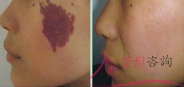 1531084654 1531084654