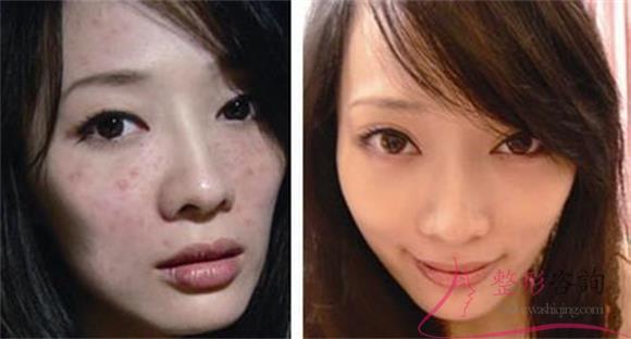 1652426073 1652426073