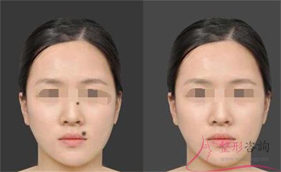 1655504997 1655504997