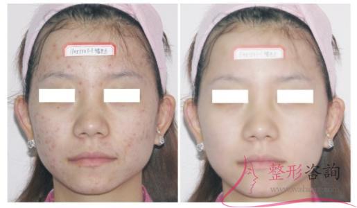 1658426231 1658426231