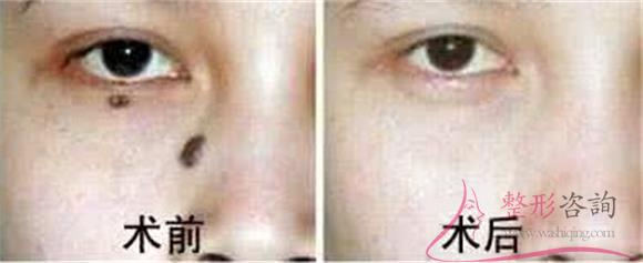 1659376037 1659376037