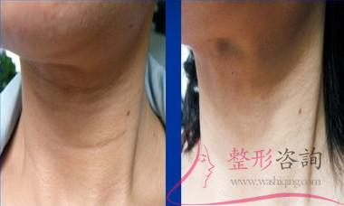 1734127132 1734127132