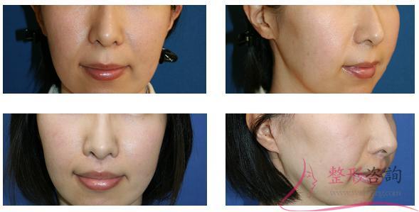 1948438034 1948438034