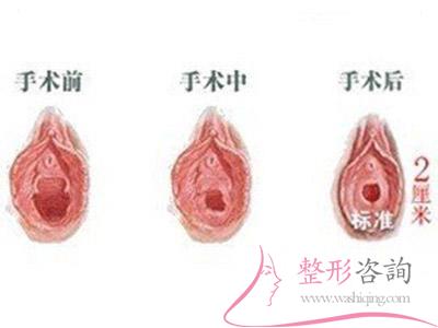 1053082193 1053082193