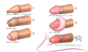 1328488980 1328488980