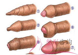 1635312768 1635312768