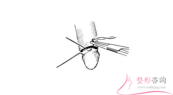 1720323088 1720323088