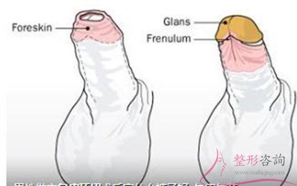 1830592144 1830592144