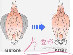 1935218720 1935218720