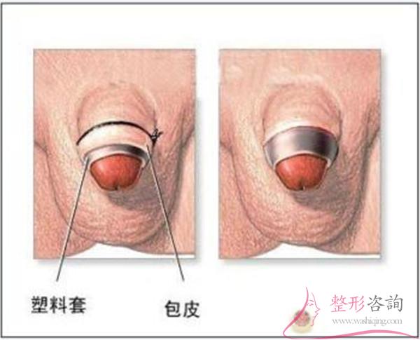 2111177845 2111177845