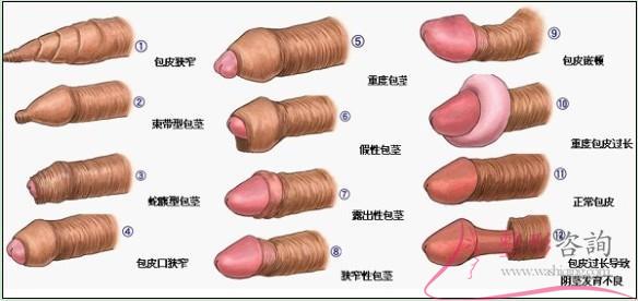 2115251547 2115251547