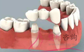 0922509191 0922509191