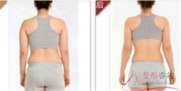 0945149237 0945149237