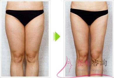 1146303747 1146303747