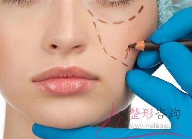 1327108524 1327108524