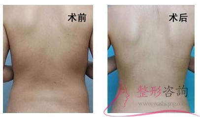 1336228823 1336228823