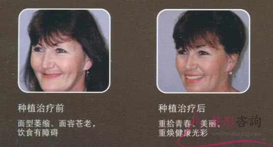 1401322921 1401322921